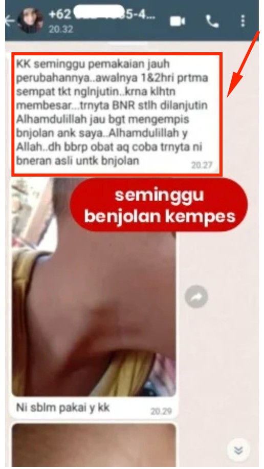 -